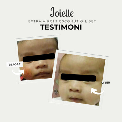 Baby Bath With Extra Virgin Coconut Oil (VCO) Special Edition (Dry & Eczema Prone Skin)